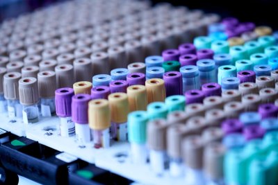 Nederland test eindelijk een screening voor prostaatkanker