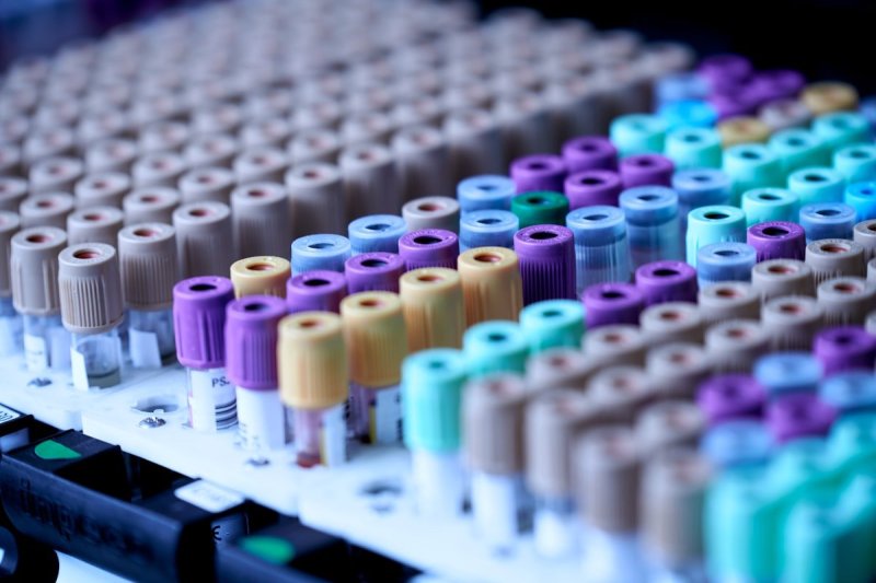 Nederland test eindelijk een screening voor prostaatkanker